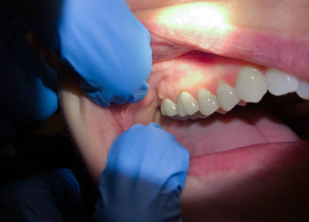 Best Emergency Root Canal Treatment in Montague, MI